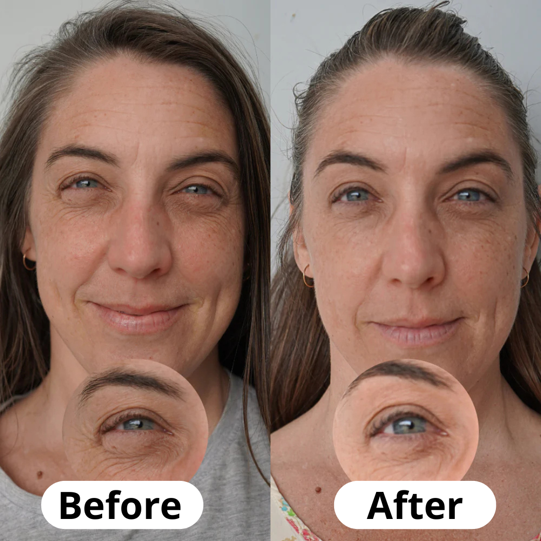 Korean Anti-Aging Calcium Balm
