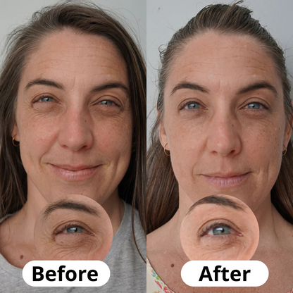 Korean Anti-Aging Calcium Balm